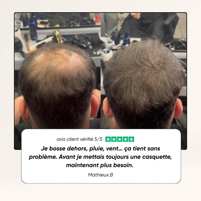 Camouflage capillaire