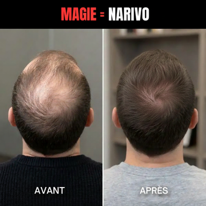 Camouflage capillaire